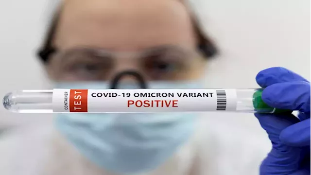 SA's COVID-19 test positivity rate dipped below 10% - SABC News - Breaking news, special reports, world, business, sport coverage of all South African current events. Africa's news leader.