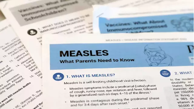 Limpopo's Health MEC concerned about the rise in measles cases - SABC News - Breaking news, special reports, world, business, sport coverage of all South African current events. Africa's news leader.