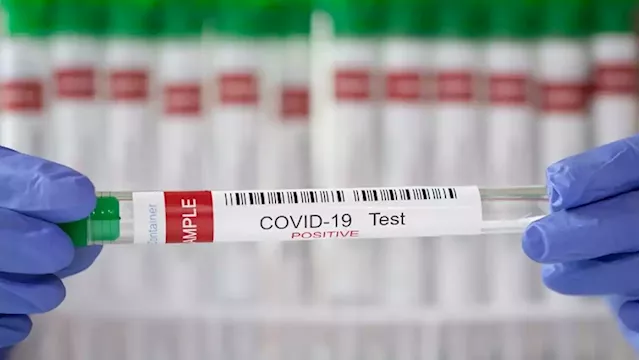 TBCSA calls on government to remove COVID-19 PCR test for vaccinated travelers - SABC News - Breaking news, special reports, world, business, sport coverage of all South African current events. Africa's news leader.