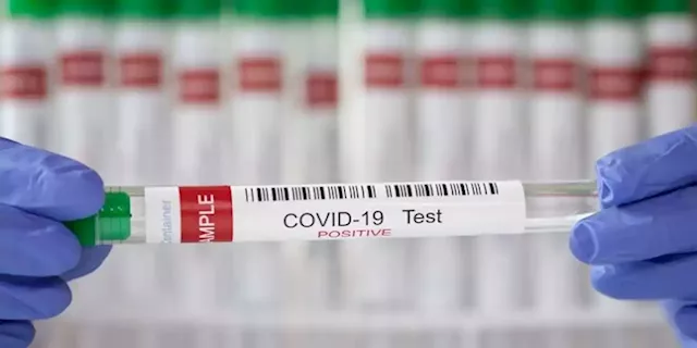 TBCSA calls on government to remove COVID-19 PCR test for vaccinated travelers - SABC News - Breaking news, special reports, world, business, sport coverage of all South African current events. Africa's news leader.