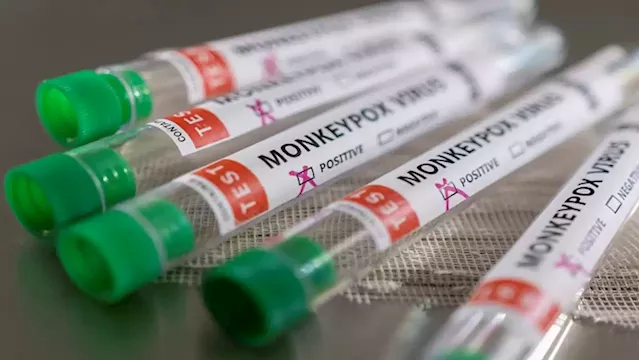 Third possible case of monkeypox found in the US - SABC News - Breaking news, special reports, world, business, sport coverage of all South African current events. Africa's news leader.