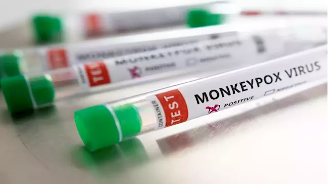 No immediate need for mass monkeypox vaccinations - WHO official - SABC News - Breaking news, special reports, world, business, sport coverage of all South African current events. Africa's news leader.