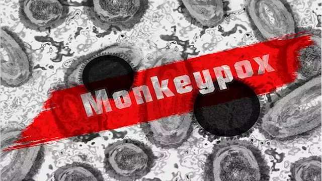 Canada reports 10 new cases of monkeypox, including the first in Ontario - SABC News - Breaking news, special reports, world, business, sport coverage of all South African current events. Africa's news leader.