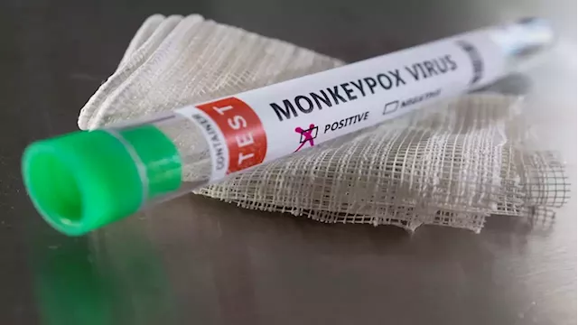 Tanzania prepares for possible Monkeypox outbreak - SABC News - Breaking news, special reports, world, business, sport coverage of all South African current events. Africa's news leader.