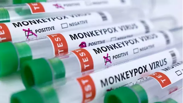 Test makers target monkeypox market as cases surge