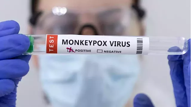 Monkeypox symptoms differ from previous outbreaks - UK study - SABC News - Breaking news, special reports, world, business, sport coverage of all South African current events. Africa's news leader.