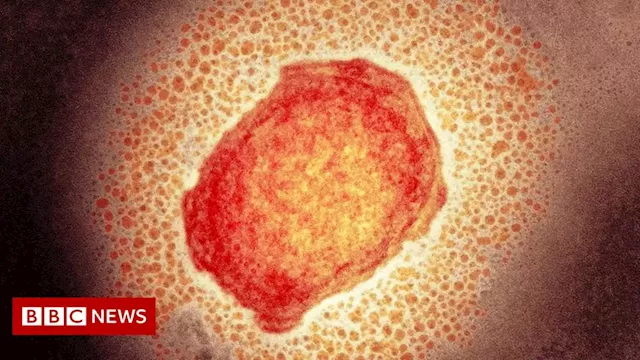 UK to offer mini dose of monkeypox jab amid low stocks