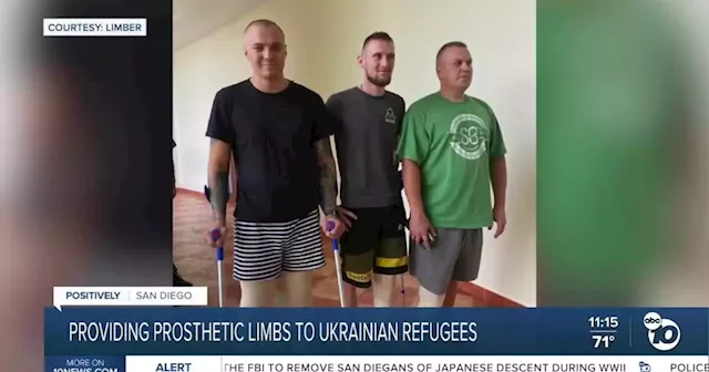 San Diego physician, company work together to donate prosthetic limbs to Ukrainian amputees