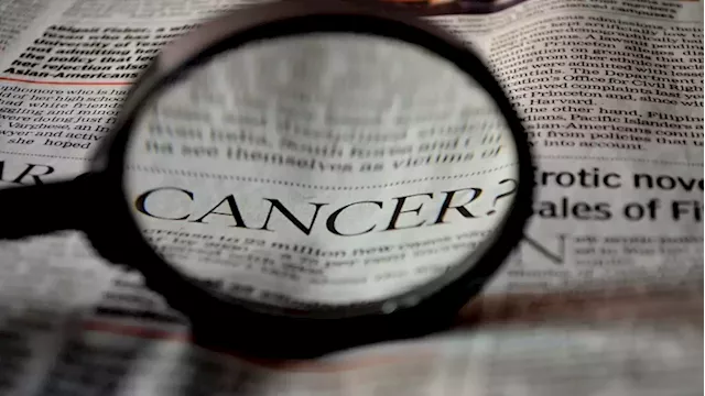 'Early detection can significantly reduce impact and cost of cancer' - SABC News - Breaking news, special reports, world, business, sport coverage of all South African current events. Africa's news leader.