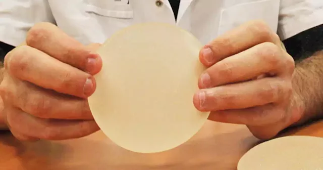 Breast implants tied to rare cancer to remain on U.S. market