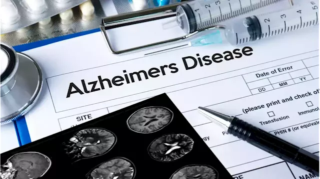 First Alzheimer's disease risk assessment blood test for consumers hits market