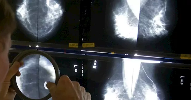 Companies plan to build largest image-based AI model to fight cancer