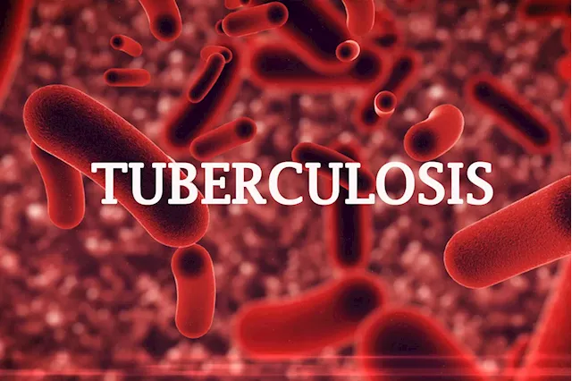 Nigeria solicits $25m private sector investment to combat TB