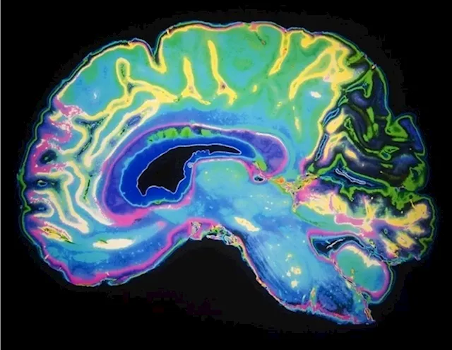 Visual cortex's impact on motor skill acquisition