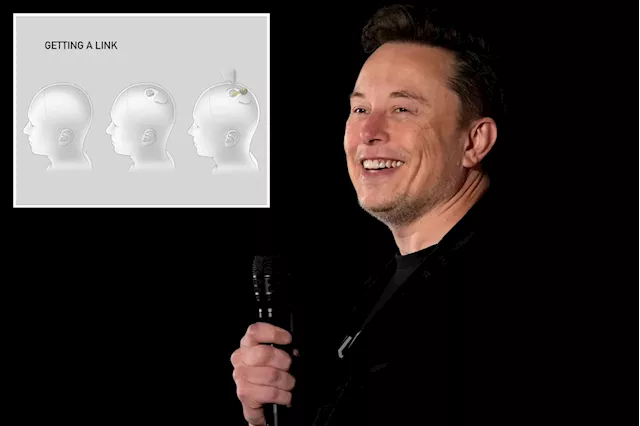 Elon Musk reveals third person received Neuralink brain chip implant as rival companies pose challenge